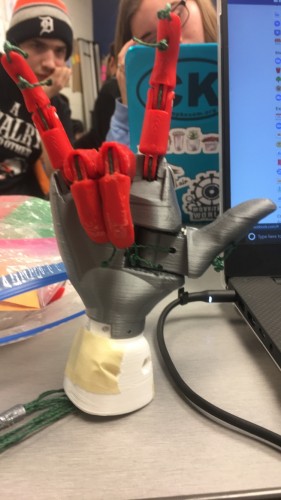 Prosthetic hand flashing the metal sign