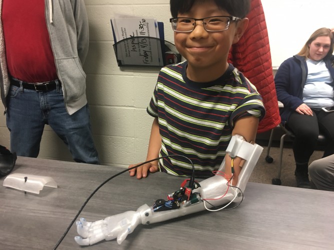 Julian with prosthetic arm