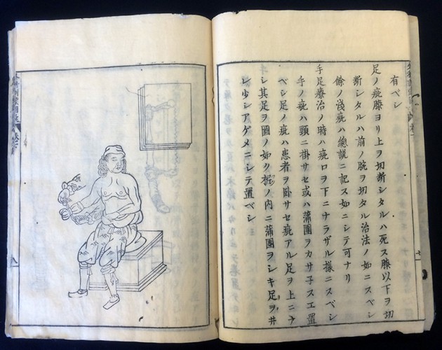 Woodcut from Irako Mitsuaki. Geka kinmō zui (Kyoto: Ebisuya Ichiemon, 1809)